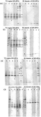 Influence of Autochthonous Putative Probiotic Cultures on Microbiota, Lipid Components and Metabolome of Caciotta Cheese